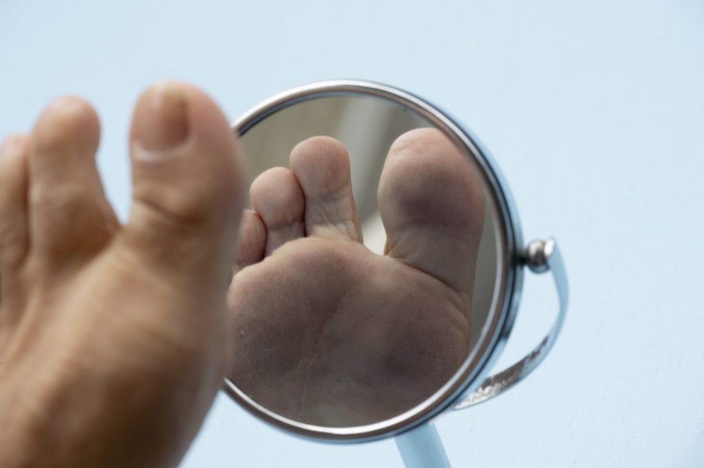 مراقب از پای دیابتی در منزل